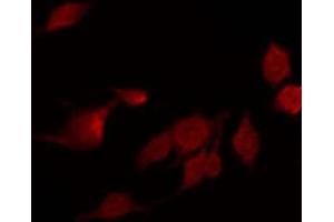 Immunofluorescence (fixed cells) (IF/ICC) image for anti-Nuclear Factor of kappa Light Polypeptide Gene Enhancer in B-Cells Inhibitor, alpha (NFKBIA) (N-Term) antibody (ABIN6262504)