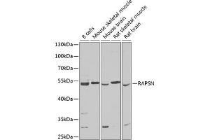 Western blot analysis of extracts of various cell lines, using RAPSN Antibody (ABIN6132583, ABIN6146690, ABIN6146691 and ABIN6222434) at 1:1000 dilution. (RAPSN 抗体  (AA 1-353))