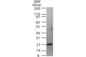 Image no. 1 for anti-Tumor Necrosis Factor (Ligand) Superfamily, Member 11 (TNFSF11) (AA 161-177) antibody (ABIN208887)
