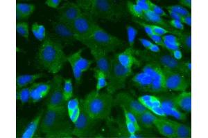 Immunofluorescence staining of SK-N-SH cells (Human neuroblastoma, ATCC HTB-11) (Second Panel). (CAMK2A 抗体  (AA 448-460))