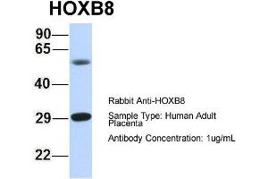 Host: Rabbit Target Name: HOXB8 Sample Type: Human Adult Placenta Antibody Dilution: 1. (HOXB8 抗体  (N-Term))
