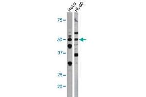 The CDC25A (phospho S75) polyclonal antibody  is used in Western blot to detect Phospho-CDC25A-S75 in Hela (left) and HL-60 (right) cell lysates. (CDC25A 抗体  (pSer76))