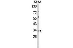 Western blot analysis of SFRP5 Antibody (Center) in K562 cell line lysates (35ug/lane). (SFRP5 抗体  (Middle Region))
