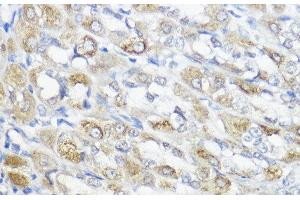 Immunohistochemistry of paraffin-embedded Rat stomach using GPX2 Polyclonal Antibody at dilution of 1:100 (40x lens). (Glutathione Peroxidase 2 抗体)