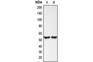 Western blot analysis of BMP3 expression in HEK293T (A), HeLa (B) whole cell lysates. (BMP3 抗体  (Center))