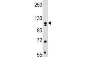 Western blot analysis of MUSK antibody and mouse kidney tissue lysate. (MUSK 抗体)
