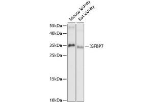 Western blot analysis of extracts of various cell lines, using IGFBP7 antibody (ABIN6131959, ABIN6142263, ABIN6142264 and ABIN6216854) at 1:1000 dilution. (IGFBP7 抗体  (AA 27-282))