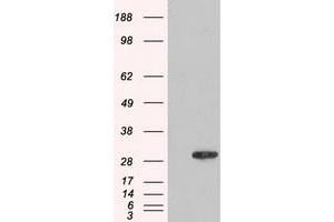 HEK293T cells were transfected with the pCMV6-ENTRY control (Left lane) or pCMV6-ENTRY AK1 (Right lane) cDNA for 48 hrs and lysed. (Adenylate Kinase 1 抗体)