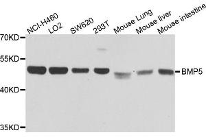 Western blot analysis of extracts of various cells, using BMP5 antibody. (BMP5 抗体)