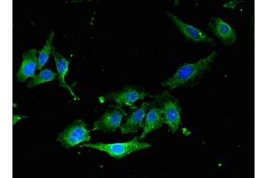 Immunofluorescent analysis of Hela cells using ABIN7167354 at dilution of 1: 100 and Alexa Fluor 488-congugated AffiniPure Goat Anti-Rabbit IgG(H+L) (RAB5 抗体  (AA 1-215))