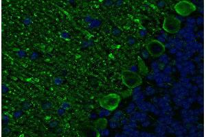 Indirect immunostaining PFA fixed paraffin embedded mouse cerebellum section (dilution 1 : 200; green). (ITPR1 抗体)