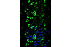 Immunofluorescence analysis of U2OS cells using GZMB antibody (ABIN5971382). (GZMB 抗体)