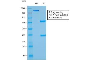 SDS-PAGE Analysis Purified Glycophorin A Mouse Recombinant Monoclonal Ab (rGYPA/280). (Recombinant CD235a/GYPA 抗体)