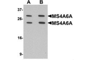 Western blot analysis of MS4A6A in 293 cell lysate with MS4A6A Antibody  at (A) 1 and (B) 2 ug/mL.