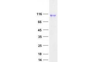 Western Blotting (WB) image for Endothelin-Converting Enzyme 1 (ECE1) (Transcript Variant 2) protein (Myc-DYKDDDDK Tag) (ABIN2719917)