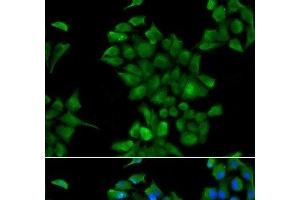 Immunofluorescence analysis of HeLa cells using CTNS Polyclonal Antibody (CTNS 抗体)