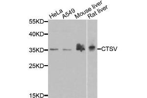 Western blot analysis of extracts of various cell lines, using CTSV antibody. (Cathepsin L2 抗体  (AA 105-334))