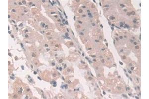 Immunohistochemistry (IHC) image for anti-Grancalcin, EF-Hand Calcium Binding Protein (GCA) (AA 1-139) antibody (ABIN7444166)