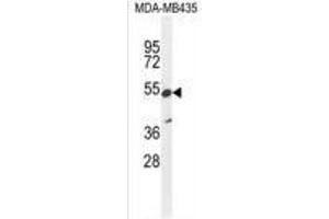 ZNF98 Antibody (C-term) western blot analysis in MDA-MB435 cell line lysates (35 µg/lane).