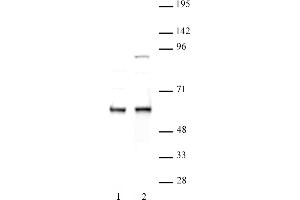 FTO antibody (pAb) tested by Western blot. (FTO 抗体  (N-Term))