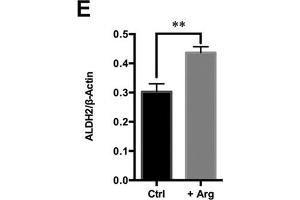 Western Blotting (WB) image for anti-Aldehyde Dehydrogenase 2 Family (Mitochondrial) (ALDH2) (AA 1-380) antibody (ABIN3021779)