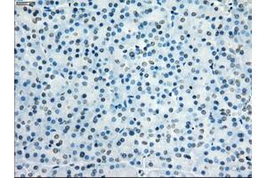 Immunohistochemical staining of paraffin-embedded colon tissue using anti-KDM4C mouse monoclonal antibody. (KDM4C 抗体)