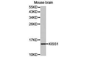 Western Blotting (WB) image for anti-KiSS-1 Metastasis-Suppressor (KISS1) antibody (ABIN1873419) (KISS1 抗体)