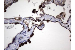 Immunohistochemistry (IHC) image for anti-Keratin Acidic (AE1) antibody (ABIN2715666) (Keratin Acidic (AE1) 抗体)