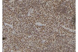ABIN6279487 at 1/100 staining Mouse spleen tissue by IHC-P. (Homeobox A11 抗体)