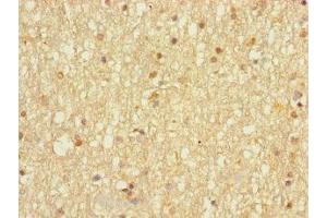 Immunohistochemistry of paraffin-embedded human brain tissue using ABIN7149614 at dilution of 1:100 (DHRS13 抗体  (AA 1-327))