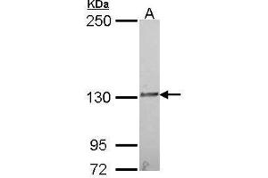 WB Image Sample (30 ug of whole cell lysate) A: A549 5% SDS PAGE IL16 antibody antibody diluted at 1:1000 (IL16 抗体  (C-Term))