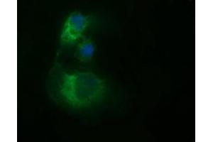 Image no. 3 for anti-Tubulin, beta 2B (TUBB2B) antibody (ABIN1501571) (TUBB2B 抗体)