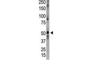 Image no. 1 for anti-Bone Morphogenetic Protein 5 (BMP5) (N-Term) antibody (ABIN357183) (BMP5 抗体  (N-Term))