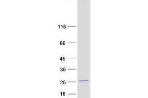 Western Blotting (WB) image for NME/NM23 Nucleoside Diphosphate Kinase 6 (NME6) protein (Myc-DYKDDDDK Tag) (ABIN2727408)