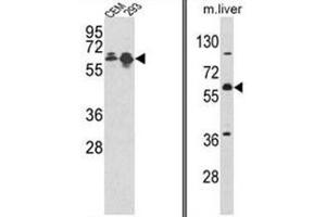 (LEFT) Western blot analysis of MCCC2 Antibody (Center) in CEM, 293 cell line lysates (35ug/lane). (MCCC2 抗体  (Middle Region))
