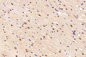 Immunohistochemistry (Paraffin-embedded Sections) (IHC (p)) image for anti-Nitric Oxide Synthase 1 (Neuronal) Adaptor Protein (NOS1AP) antibody (ABIN7074844)