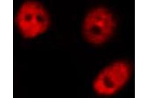 ABIN6267432 staining HeLa by IF/ICC.