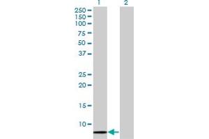 Western Blot analysis of SCGB1A1 expression in transfected 293T cell line by SCGB1A1 monoclonal antibody (M11), clone 1F7.