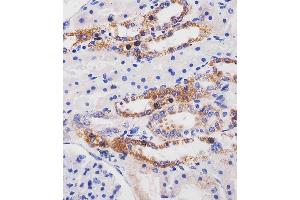 (ABIN6244111 and ABIN6577256) staining ME2 in human kidney tissue sections by Immunohistochemistry (IHC-P - paraformaldehyde-fixed, paraffin-embedded sections). (NAD-ME 抗体  (C-Term))