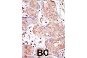 Immunohistochemistry (IHC) image for anti-Male Germ Cell-Associated Kinase (MAK) antibody (ABIN3003276) (MAK 抗体)