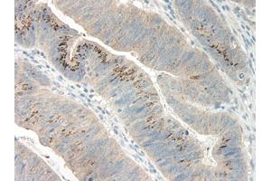 Image no. 1 for anti-Growth Regulated Oncogene gamma (GRO gamma) antibody (ABIN465908) (GRO gamma 抗体)