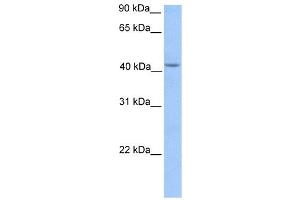 HMBS antibody used at 1 ug/ml to detect target protein. (HMBS 抗体  (Middle Region))
