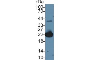 Western Blot; Sample: Mouse Liver lysate; Primary Ab: 2µg/ml Rabbit Anti-Mouse PRDX1 Antibody Second Ab: 0. (Peroxiredoxin 1 抗体  (AA 1-199))