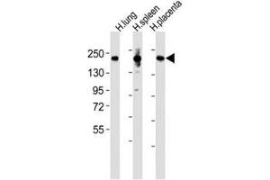 Western blot testing of MRC1L1 antibody at 1:2000 dilution and human samples: Lane 1: lung lysate