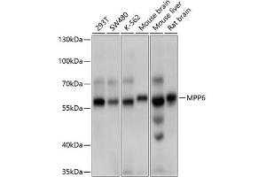 Western blot analysis of extracts of various cell lines, using MPP6 antibody (ABIN6132328, ABIN6143972, ABIN6143973 and ABIN6214790) at 1:1000 dilution. (MPP6 抗体  (AA 220-420))