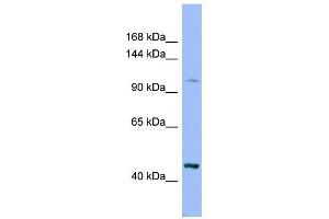 XYLT2 antibody used at 1 ug/ml to detect target protein. (XYLT2 抗体  (Middle Region))