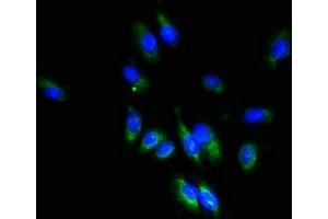 Immunofluorescent analysis of Hela cells using ABIN7171842 at dilution of 1:100 and Alexa Fluor 488-congugated AffiniPure Goat Anti-Rabbit IgG(H+L) (TSPAN1 抗体  (AA 110-211))