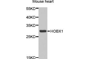 Western blot analysis of extracts of mouse heart, using HOXB1 antibody (ABIN5973981) at 1/1000 dilution. (HOXB1 抗体)