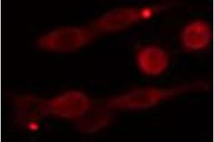 ABIN6274280 staining Hela cells by IF/ICC. (DGKE 抗体  (Internal Region))