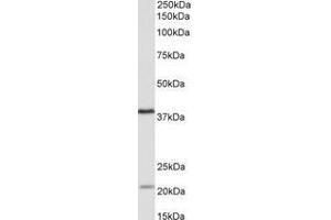 Image no. 1 for anti-Kelch Domain Containing 8B (KLHDC8B) (AA 259-270) antibody (ABIN1102756) (KLHDC8B 抗体  (AA 259-270))